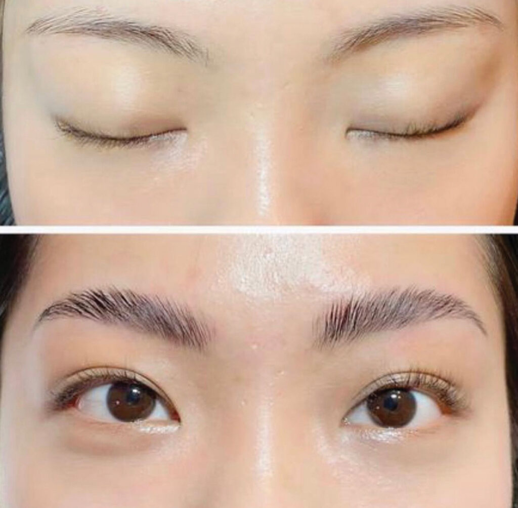 Eyebrow Lamination Before And After