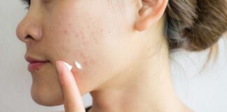 Tretinoin Picture Ii