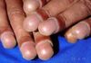 Nails 1
