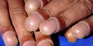 Nails 1