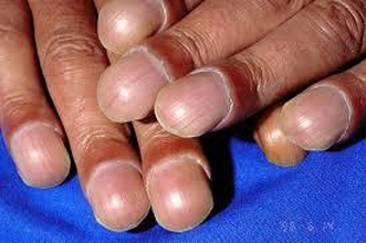 Nails 1
