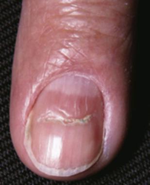 Nails 2