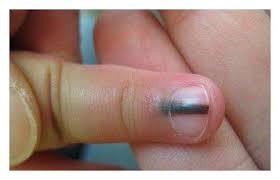 Nails 4