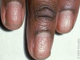 Nails 5